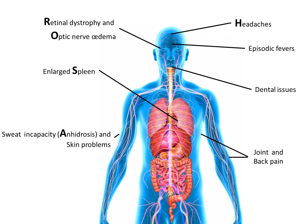 Main ROSAH Symptoms